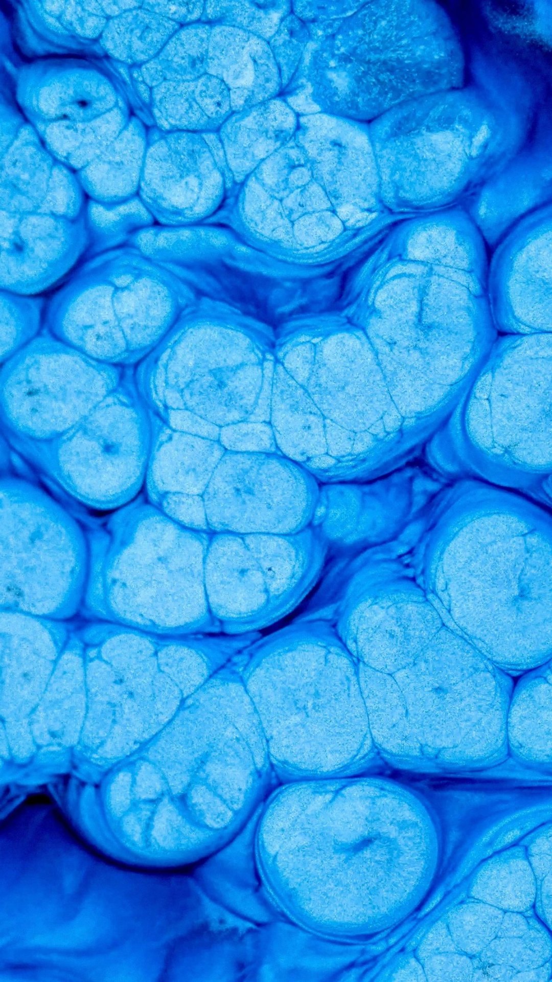 Hereditary Cancer Panels