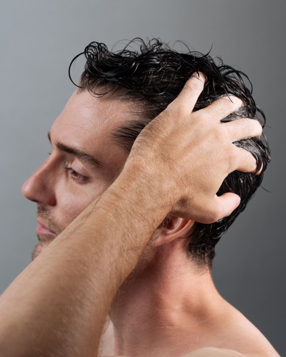 Hair Loss