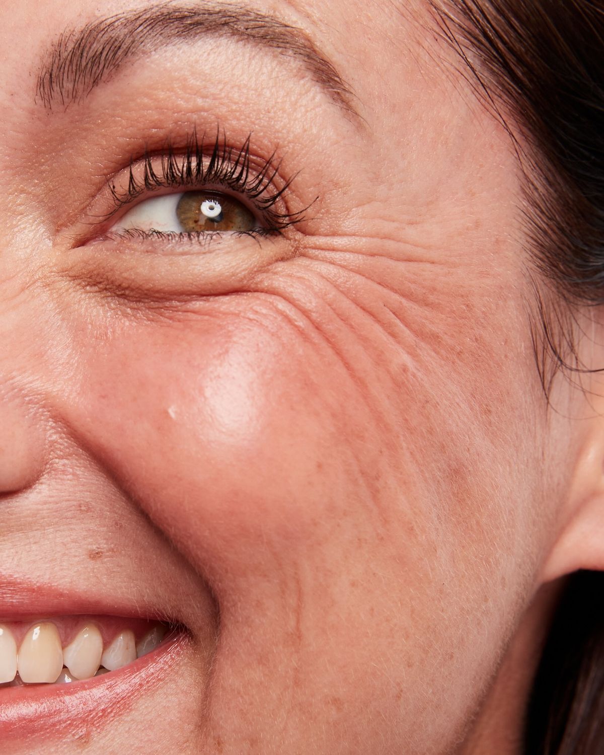 Fine Lines & Wrinkles