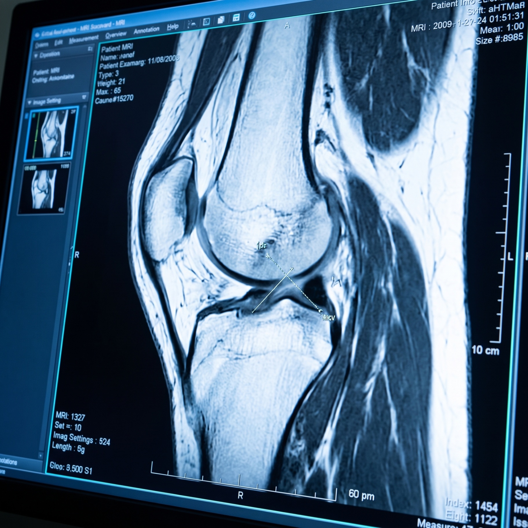 Musculoskeletal