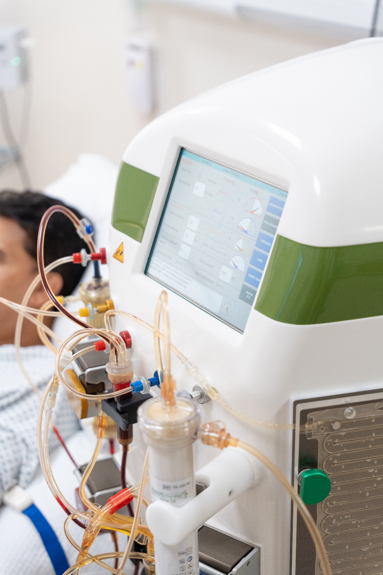 Therapeutic Plasmapheresis at Lifecore
