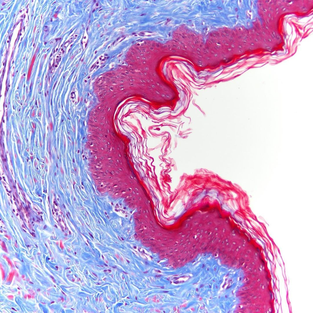 Exosome Therapy at Lifecore