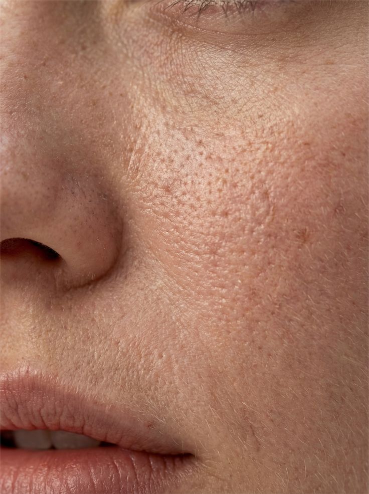 Pore & Texture