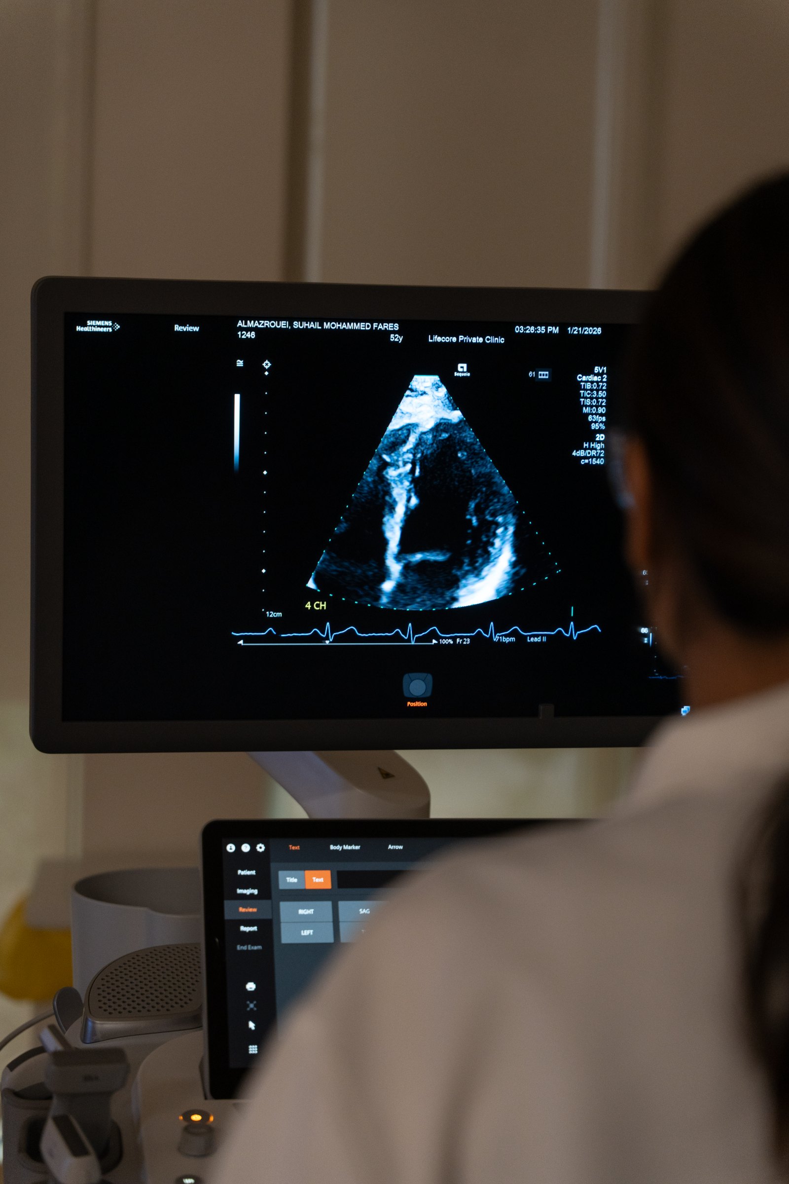 Cardiac imaging
