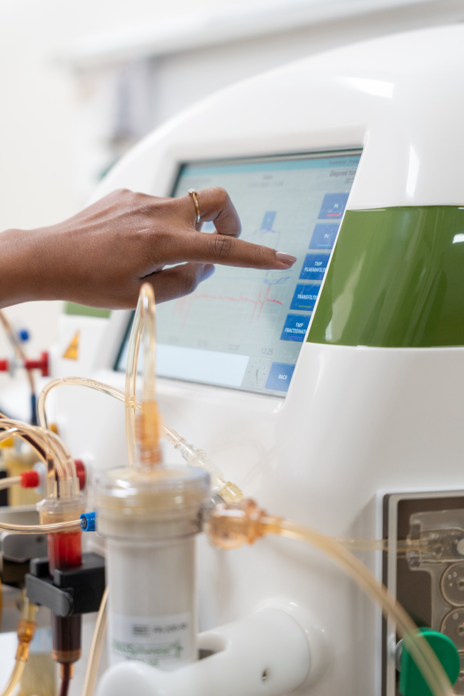 Therapeutic plasmapheresis